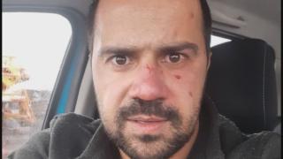 ТВ водещ твърди, че е бит жестоко от държавни служители след преследване СНИМКА