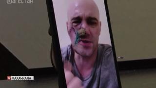 Руски войник изгуби лицето си в Украйна, но спаси другарите си от смърт ВИДЕО 18+