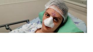 Извършиха операцията на младата Петя, която беше нахапана от куче