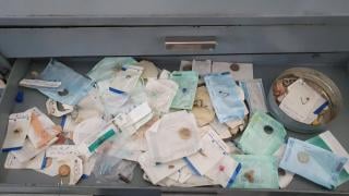 Шок! Лекари извадиха метални сачми от носа на дете в София 