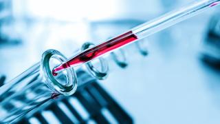 Кои кръвни изследвания си струва да правим всяка година