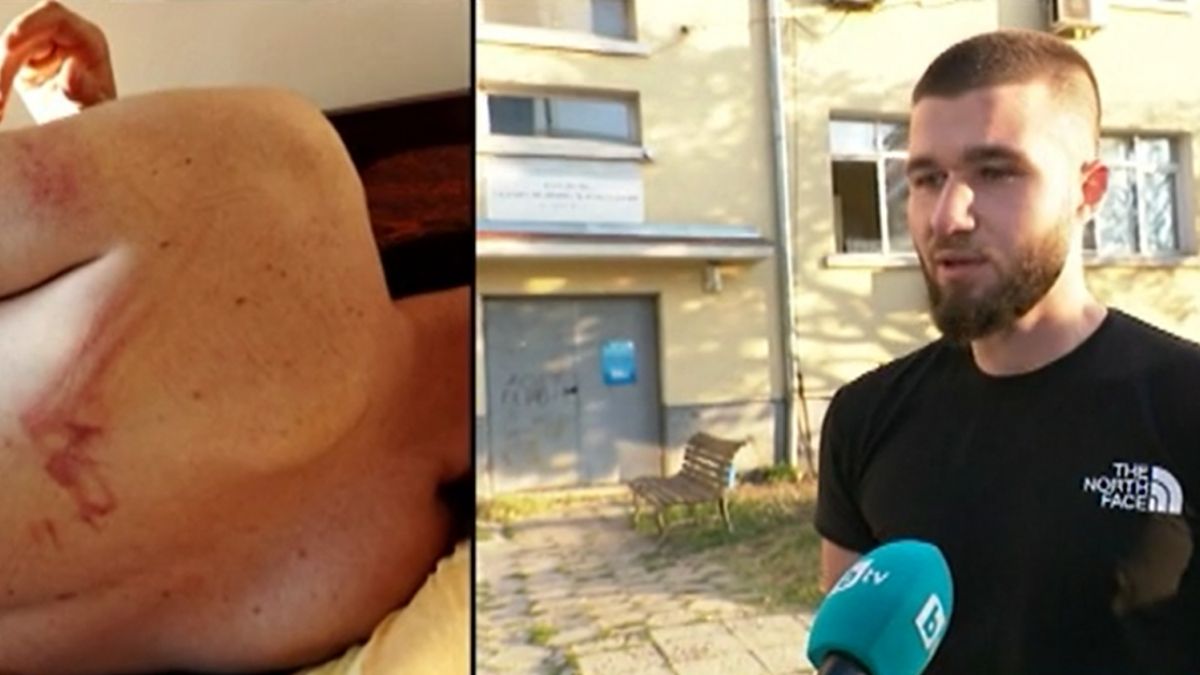 Шокиращ разказ: 22 г. мъж от Козлодуй проплака как петима полицаи са го били с палка и... ВИДЕО