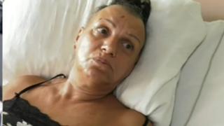 Брутален разказ на пострадалата в зрелищната катастрофа с младок във Видин