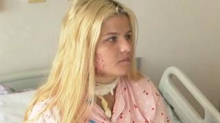 Проговори 18 г. Теодора, ударена от мълния, ето какво се случва с нея ВИДЕО