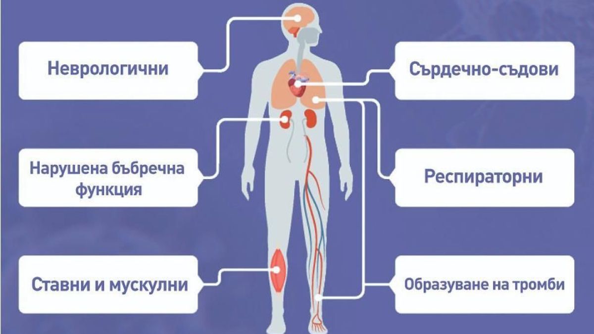 Ужас: Всеки пет е измъчван от К-19 много след преболедуването на вируса