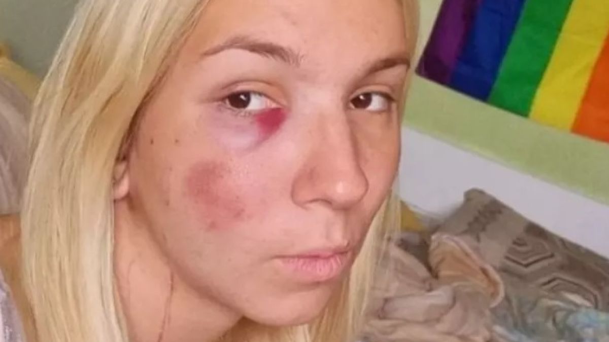 Емили Тротинетката е направила два опита за самоубийство в неделя заради...