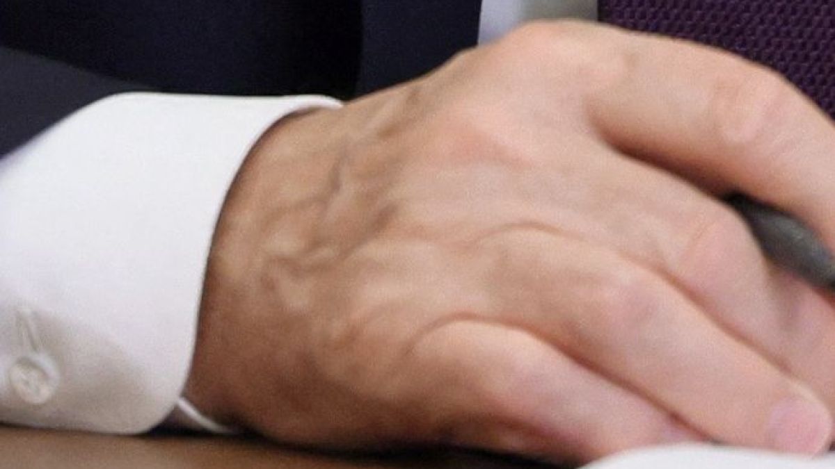 Нови белези по дясната ръка на Путин засилиха съмненията за тежката битка с рака 