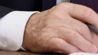 Нови белези по дясната ръка на Путин засилиха съмненията за тежката битка с рака 