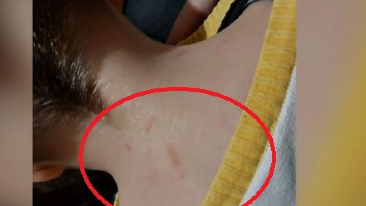 5-г. момче се прибра със синини от детската градина, а педагожките дадоха странно обяснение ВИДЕО