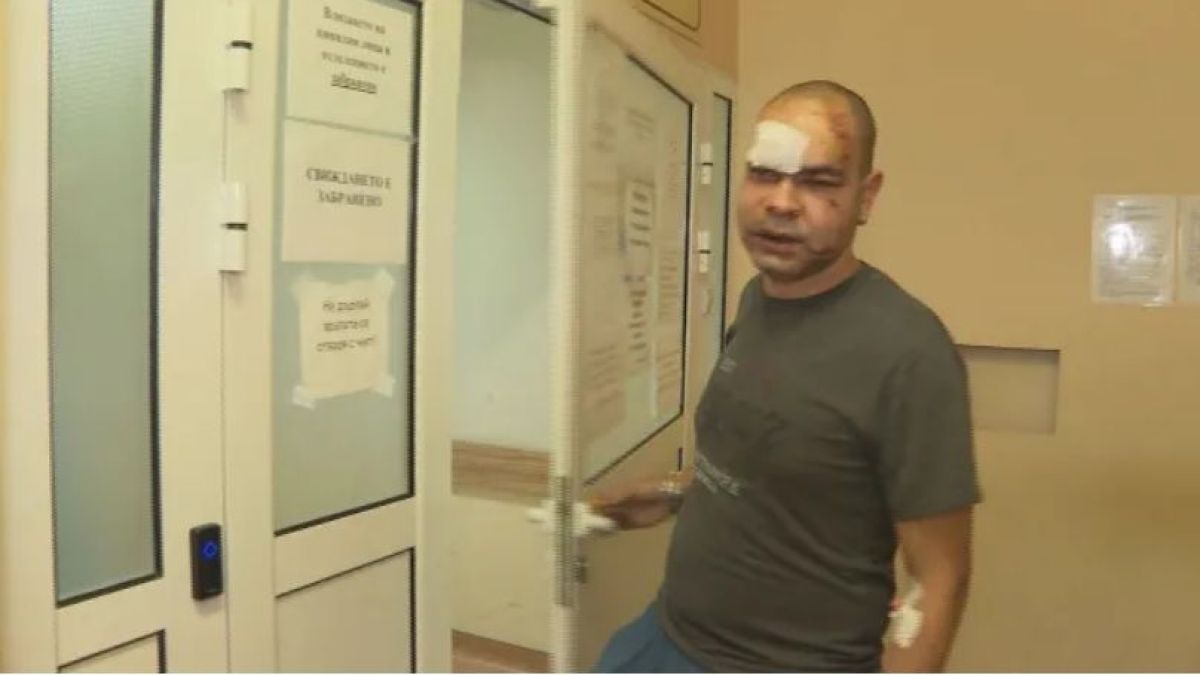 Шокиращи СНИМКИ на пребития медик във Враца: Избити са ми зъби, зашит съм на устната и челото 18+