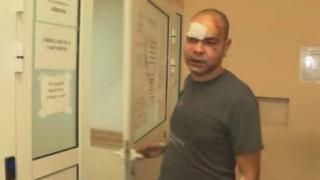 Извънредна новина за бияча на спешния медик от Враца 