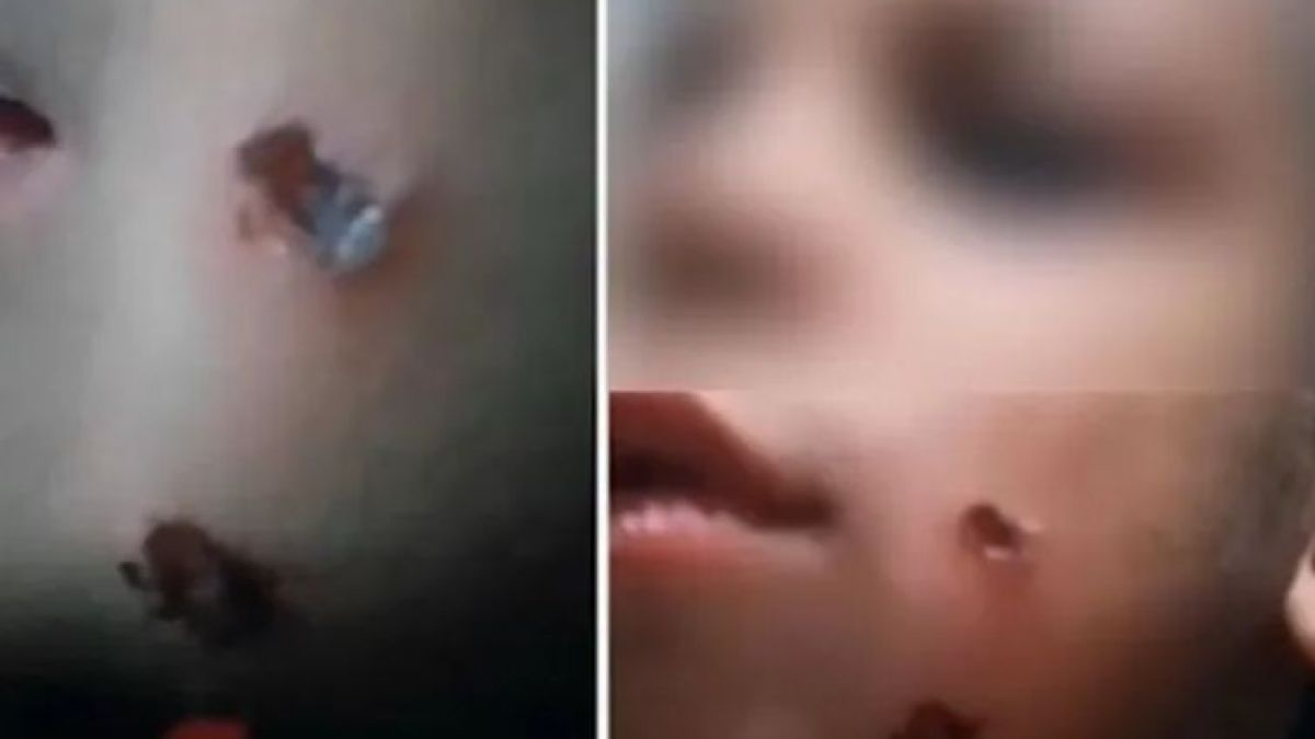 Нови разкрития за бруталните СНИМКИ 18+ на детето с прогорени бузки