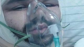 Радев попиля РСМ заради пребития Християн, появи се кървава СНИМКА 18+ от болничната му стая