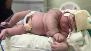 7-килограмово зверче проплака в бразилска болница, а майката... ВИДЕО