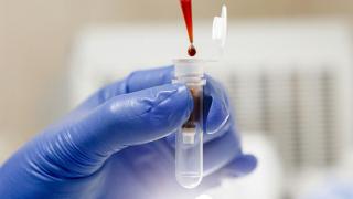 Москва: Американците са правили експерименти с ХИВ в Украйна