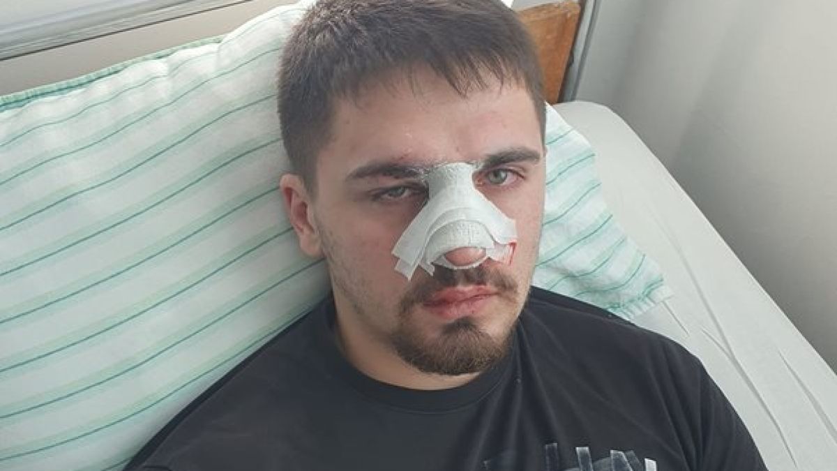 Четирима биха на убиване младеж пред дискотека в Плевен, баща му твърди, че са полицаи