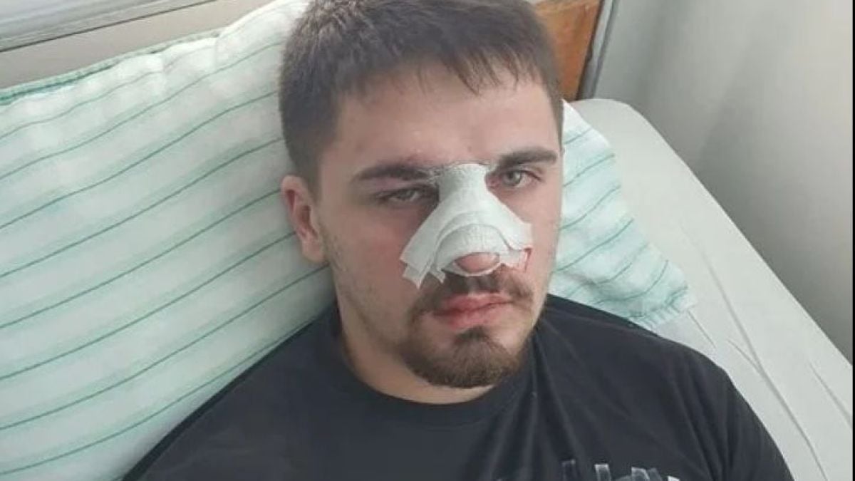 Извънредна вест за ченгетата от Плевен, едва не убили 19-г. Емил!
