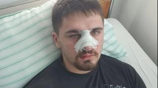 Извънредна вест за ченгетата от Плевен, едва не убили 19-г. Емил!