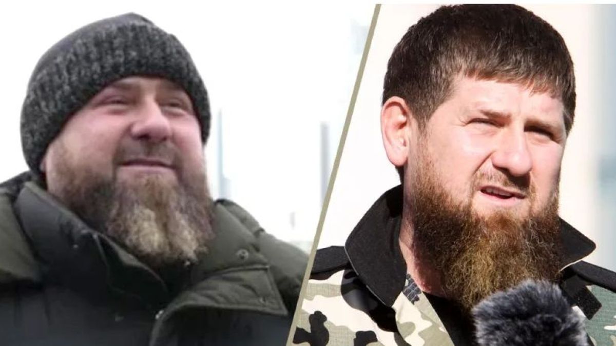 Bild: Рамзан Кадиров има сериозни здравословни проблеми 