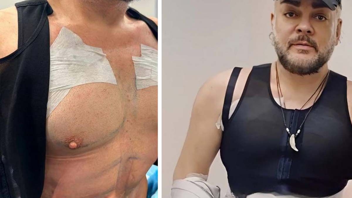 Филип Киркоров шашна с приумица, вече изглежда като... СНИМКИ