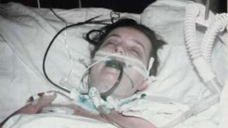 Ужас! Българка бере душа след инжекции за отслабване в частна турска клиника