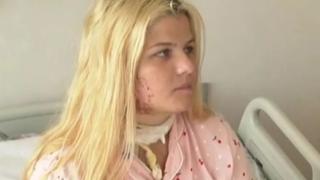Помните ли Теодора, ударена от мълния в Приморско? Ето какво се случва с нея ВИДЕО
