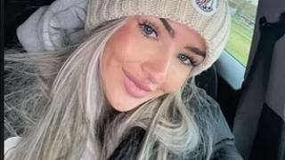 Ужасяващи СНИМКИ на красавица, пекла се на Карибите без предпазващ крем