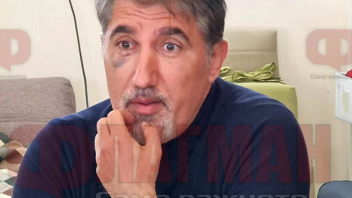 Башар Рахал цъфна в Бургас с насинено око, какво се случва с актьора СНИМКА 