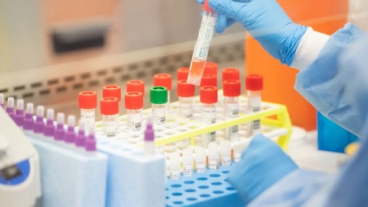 Ето каква е ситуацията с COVID-19 у нас за последните 24 часа