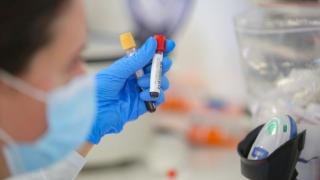 Сводка: Лоша тенденция се забелязва относно К-19 за четвъртък