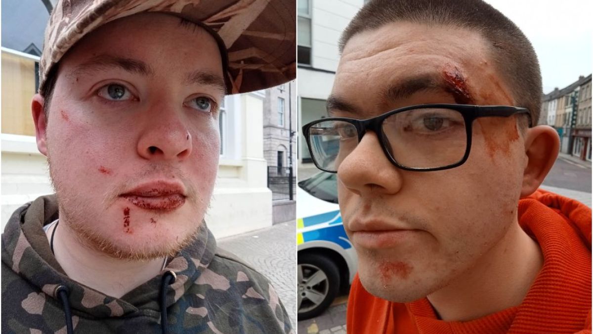 Ритан и удрян до смърт: Кървава свада с над 20 гамени от България и Румъния в Северна Ирландия