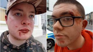 Ритан и удрян до смърт: Кървава свада с над 20 гамени от България и Румъния в Северна Ирландия