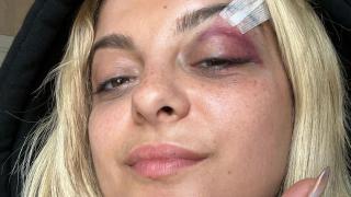 Бесен фен нацели певица в лицето с телефона си, повали я на земята и... ВИДЕО 