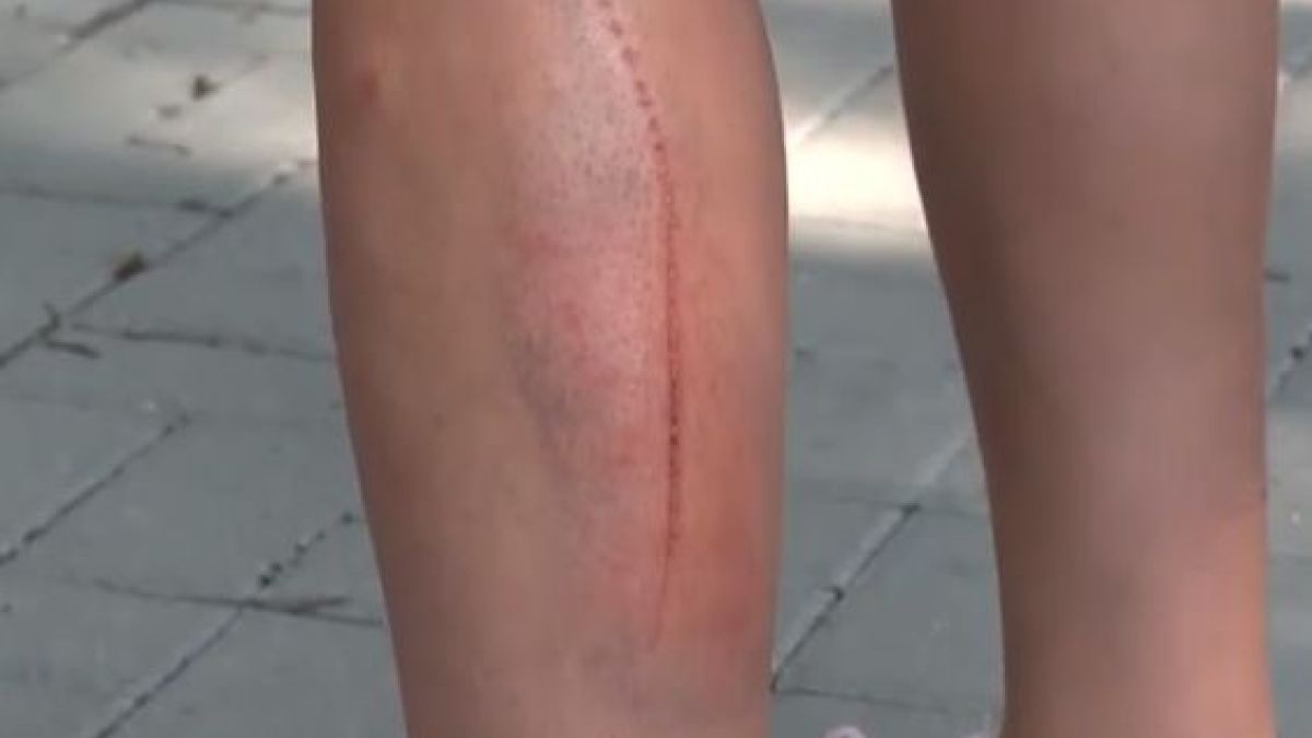 Ужас в София! Ограда за малко да убие дете с Даун ВИДЕО
