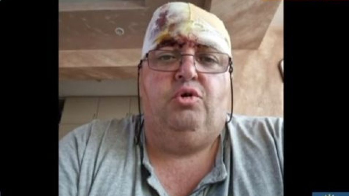 Лекарят, оцелял по чудо в линейката-ковчег, с ужасяващ разказ за касапницата 