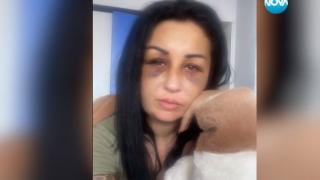 Приятел на касапина Жоро също смазвал от бой жена си, тя показа какво й е причинил и проговори за ужаса ВИДЕО 18+ 