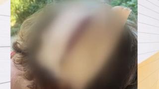Пребита с кол заради куче: Кървава история от Оряхово потресе всички ВИДЕО 18+