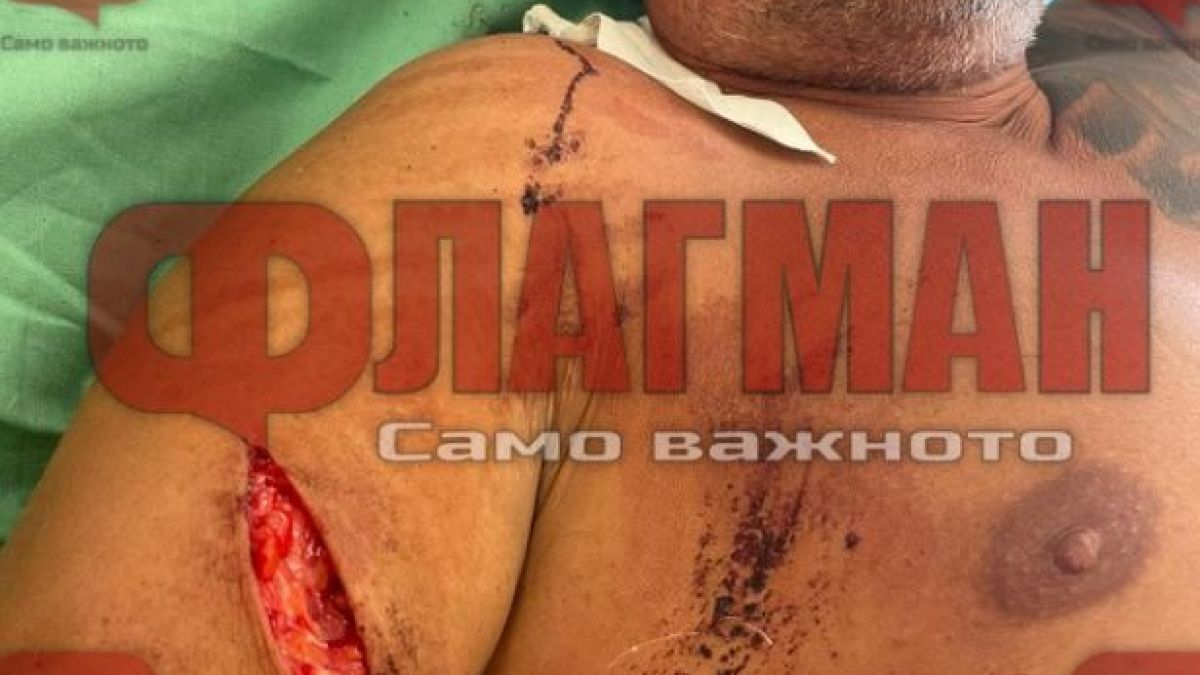  Ъндърграунд героят, клан посред бял ден в Свети Влас, с ексклузивни разкрития за душманина си СНИМКА 18+