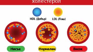 Внимание: Този симптом говори за опасни нива на холестерола