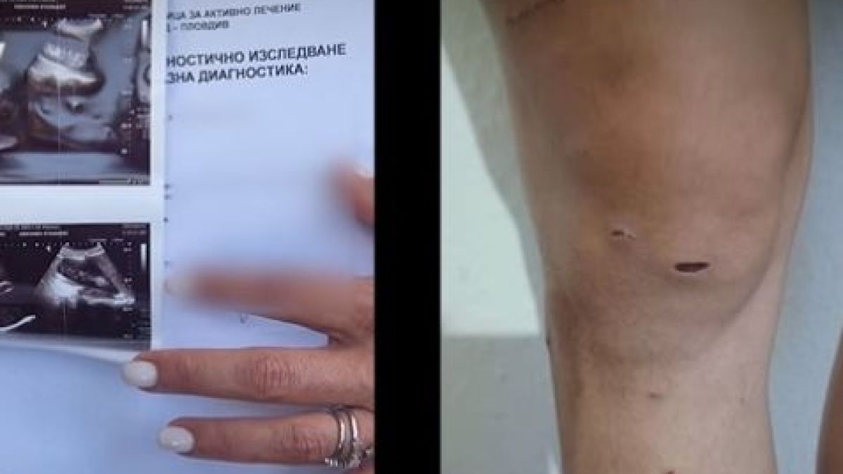 Дебора 2: Дупчена с шило, стреляна и бита 3 дни се оказа с лека телесна повреда, а 27-г. й насилник Денис... ВИДЕО 18+