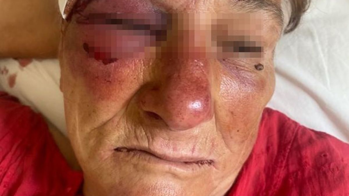 Брутално! Изрод млати с тенджера и опита да изнасили възрастната Елена, която беше пребита с бухалка преди месец СНИМКИ 18+