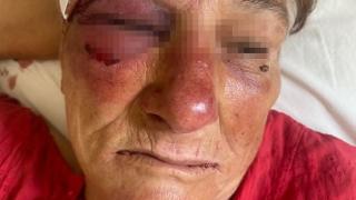Брутално! Изрод млати с тенджера и опита да изнасили възрастната Елена, която беше пребита с бухалка преди месец СНИМКИ 18+