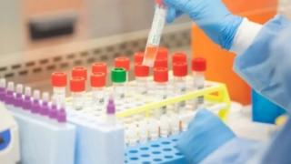 Последни данни за размаха на COVID-19 у нас за денонощие