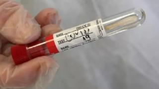Сводка: Така стоят нещата с К-19 тази сряда