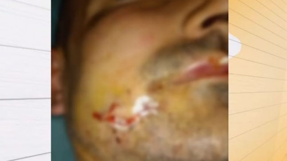 Брутално меле в Горна Оряховица: Казаха ми, че няма проблеми, а се събудих в линейката! ВИДЕО 18+