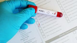 Свинският грип настъпва у нас, покоси 4-годишно дете