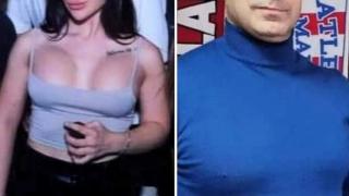 Ивка Бейбе не е единствената жертва на пишман хирурга, ето кои са другите звезди със силикон до шията СНИМКИ