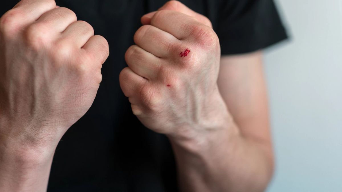 Смляха от бой 26-г. мъж в павелбанско село