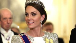 Изтриват изтеклата СНИМКА на Кейт след операцията, вижда се нещо плашещо!