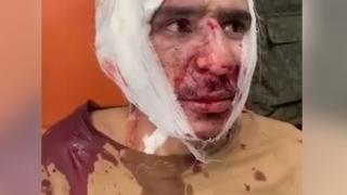 Шокиращо ВИДЕО 18+ от разпитите на терористите, окървавили Подмосковието